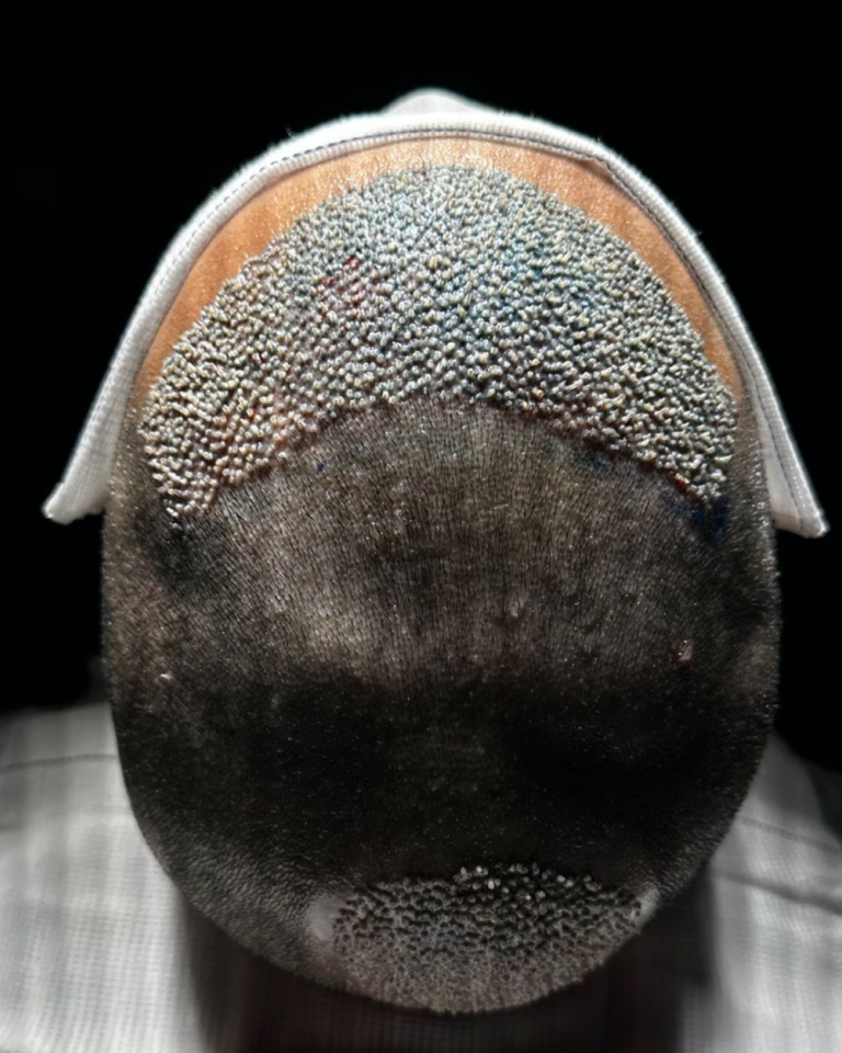 Mask group (5)